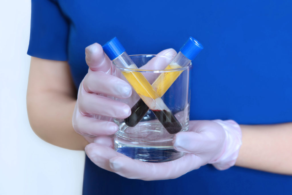 Platelet-Rich Plasma - PRP